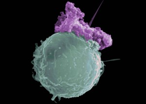 Apoptosis Cells